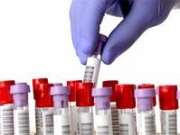 Laboratorio Analisis Clinicos